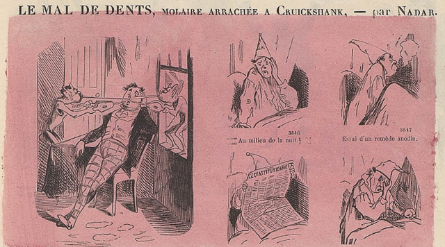 Extracting a molar.